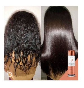 Perfecta Biodefinitive System